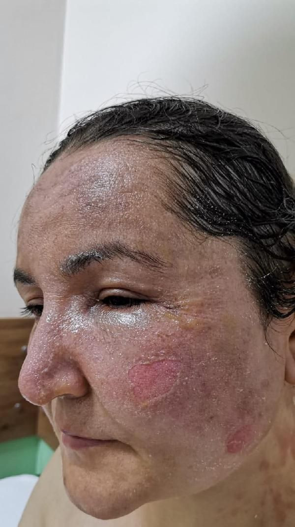 Diyarbakır'da dehşet! Çocuklarının gözü önünde eşini kızgın yağ ve kaynar su ile haşladı - Resim: 1