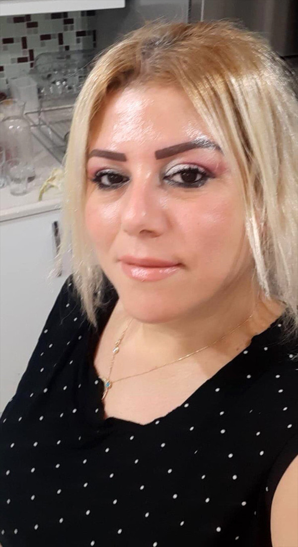 Adana'da estetik hayatına mal oldu: İçtiği su boğazından geri geliyordu - Resim: 3