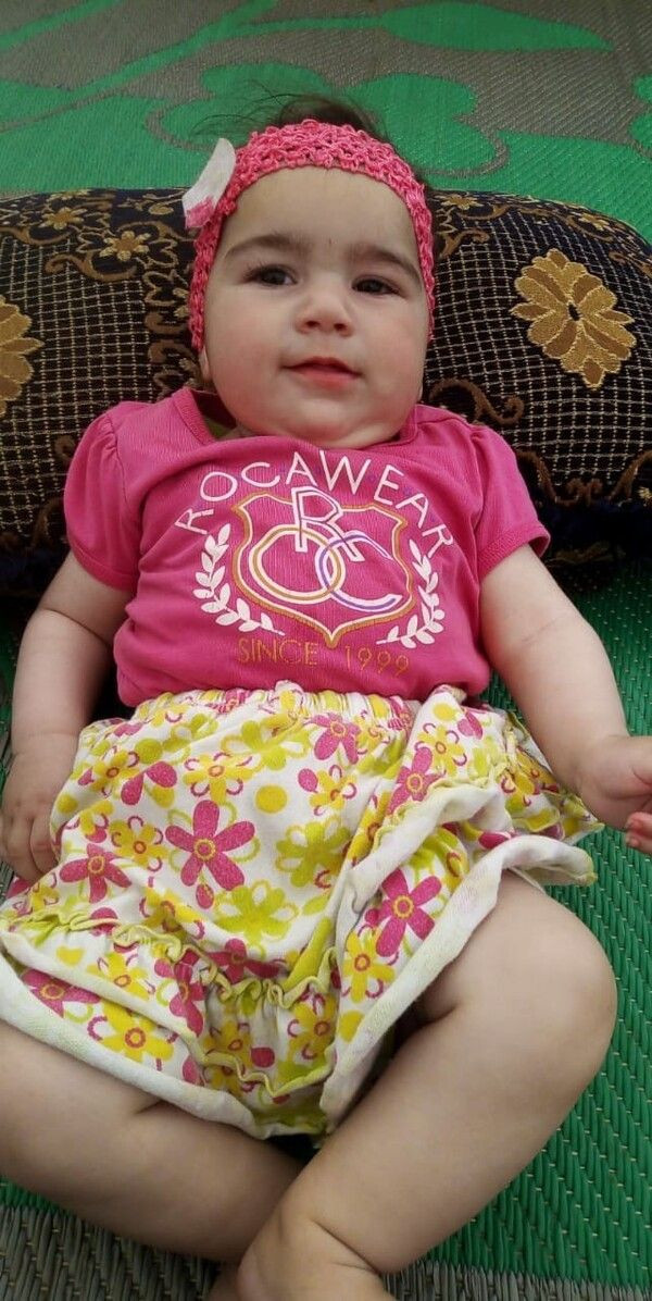 'Yüzde 90 yaşamaz' denildi! Mersin'de 2 yaşındaki bebek doktorları bile şok etti - Resim: 2