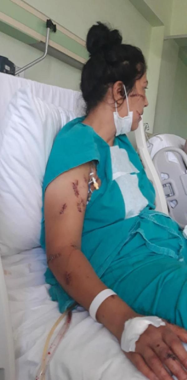 Abdest alıp 104 yerinden bıçakladı! Çocuğunun annesi can çekişirken başında sigara içti - Resim: 4