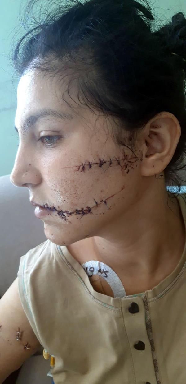 Abdest alıp 104 yerinden bıçakladı! Çocuğunun annesi can çekişirken başında sigara içti - Resim: 3