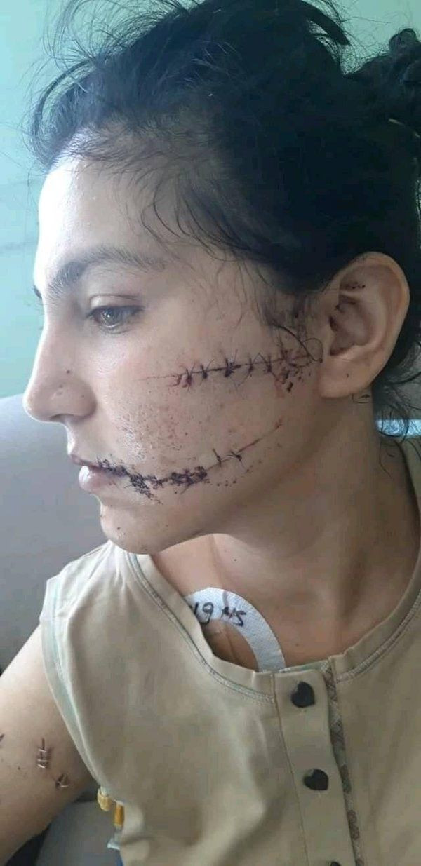 İzmir'de vahşet! Dini nikahlı eşini 104 yerinden bıçaklayıp ölmesini beklemiş! - Resim: 2