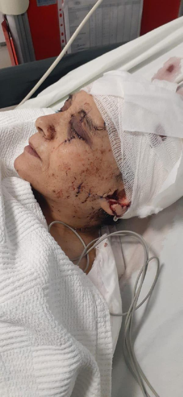 Satırlı dehşet! Çalışmasını istemediği eşine kabusu yaşattı - Resim: 0