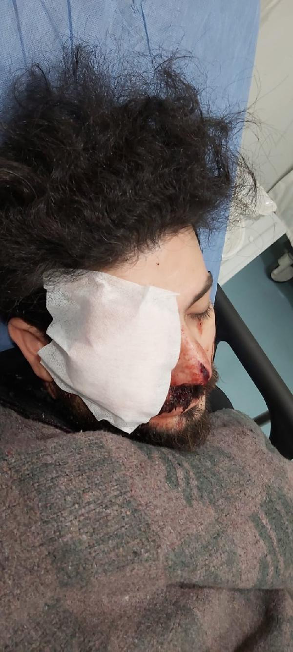 Maganda kuruşunuyla gözünü kaybeden Şahan Dinç dehşet anlarını anlattı - Resim: 1