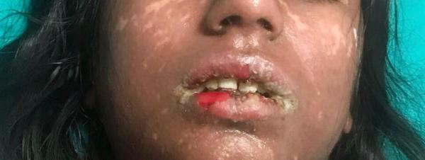 Liseli kızı bu hale getiren ne? Şok iddia - Resim: 4