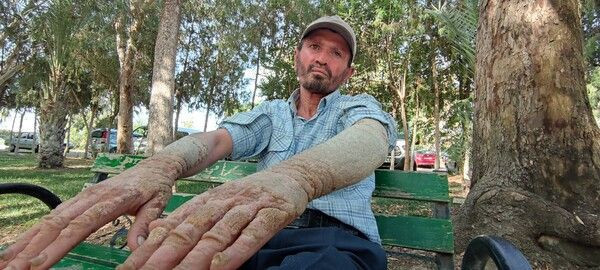 Sabah uyanınca fark etti hayatı kabusa döndü! Antalya'da onu gören kaçıyor! - Resim: 1