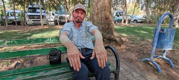 Sabah uyanınca fark etti hayatı kabusa döndü! Antalya'da onu gören kaçıyor! - Resim: 2