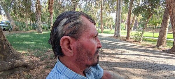 Sabah uyanınca fark etti hayatı kabusa döndü! Antalya'da onu gören kaçıyor! - Resim: 4