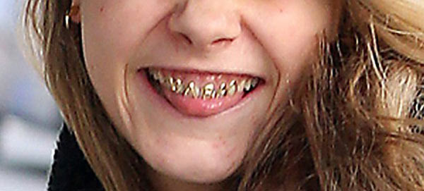 Cara Delevingne'nin dişleri görenleri korkuttu - Resim: 4