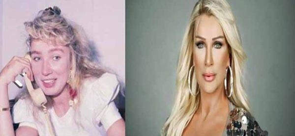 Pınar Altuğ şaşırttı! Ona bir de estetiksiz bakın - Resim: 2