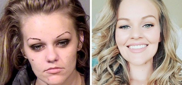 Uyuşturucudan bu haldeydi şimdi bambaşka! - Resim: 1