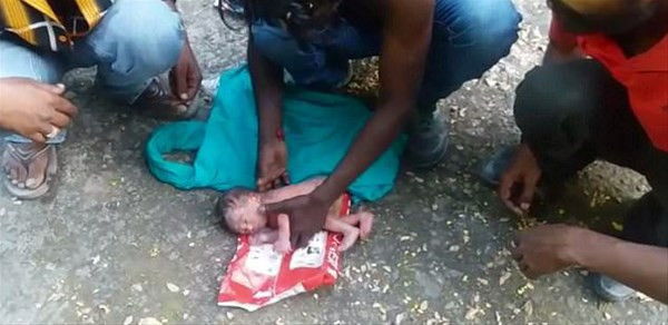 Çöpte dehşete düşüren görüntü vücuduna baktılarında ise... - Resim: 3