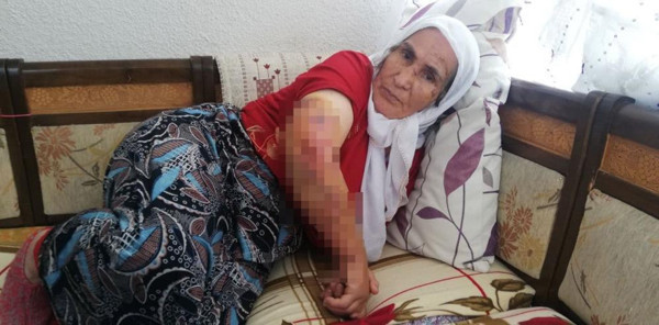 Tokat'ta feryatları duyan koştu! Yaşlı kadın kanlar içinde kaldı - Resim: 0