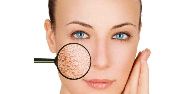 Doğal diyerek cildinize sürmeyin! Yüzünüzü güzelleştirmek isterken daha kötü hale sokabilirsiniz - Resim: 0