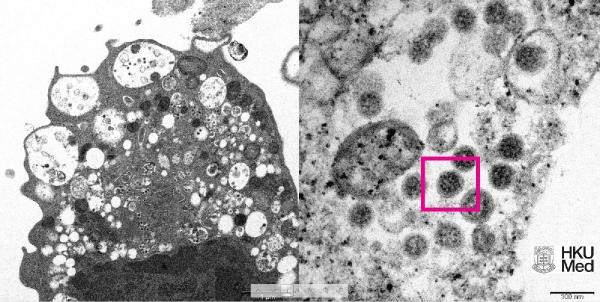 Yeni kabus! Omicron varyantının elektron mikroskobu görüntüsü yayınlandı - Resim: 0