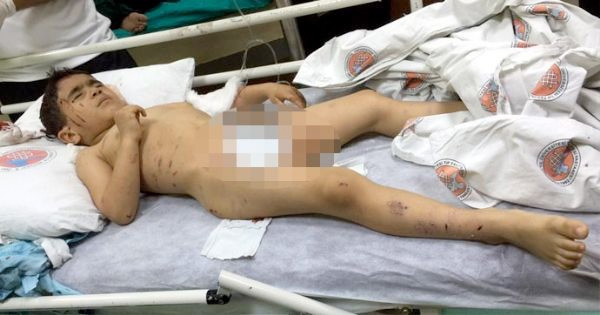 Van'da dehşet 8 köpek 5 yaşındaki çocuğa saldırdı - Resim: 1