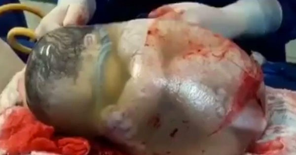 Bebek bu halde dünyaya geldi doktorlar şoke oldu - Resim: 4