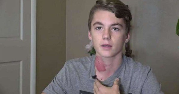 Onu arkadaşlar bir şaka uğruna bu hale getirdi sebebi ise korkunç - Resim: 3