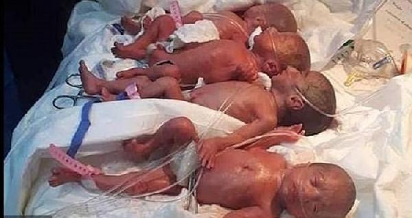 Malili kadın 9 çocuk dünyaya getirdi - Resim: 0