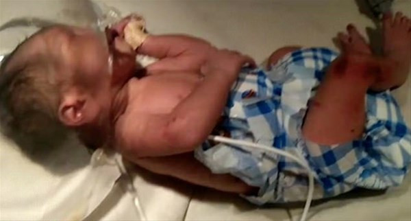 Çöpte dehşete düşüren görüntü vücuduna baktılarında ise... - Resim: 4