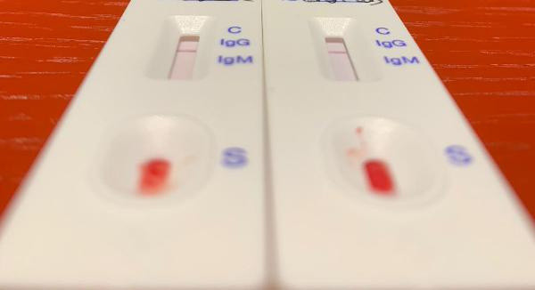 Uzmanlardan evde hızlı Kovid testi yapanlara uyarı: Kovid teşhisi için kullanılamaz - Resim: 0