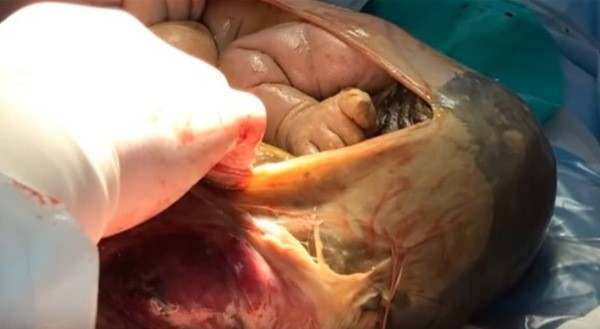 41 Haftalık hamileydi doktora gitmedi ama muayene edilince... - Resim: 4