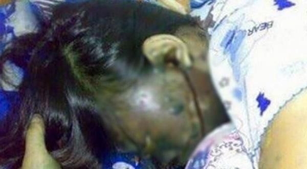 Kulaklık takıp uyuyorsanız bir daha yapmayın! Sonu kötü oldu - Resim: 4