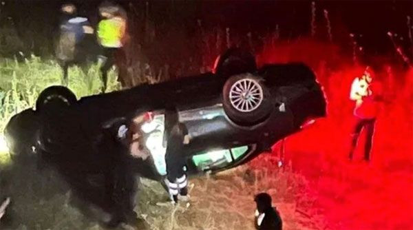 Bodrum'da kaza yapmış ağır yaralanmıştı! Ünlü model korkunç kazanın detaylarını anlattı "Bilerek kolumu kırdım" - Resim: 2