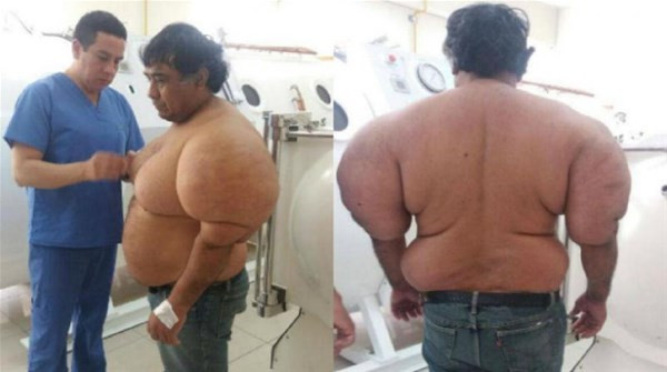 Denize girdi bu hale geldi görenler şoke oluyor! - Resim: 2