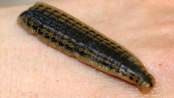 Covid-19 aşısı oldu! Aşıyı emmesi için koluna bakın ne yaptı: Hemşire görünce isyan etti - Resim: 0