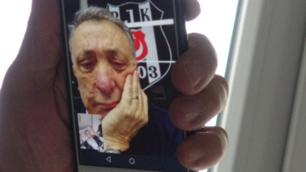 Ahmet Nur Çebi 13 yıldır yatağa mahkum Beşiktaş taraftarına müjdeyi verdi - Resim: 0
