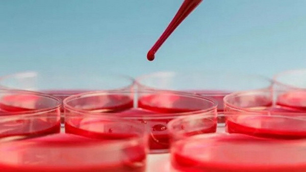 Bu kan grubundaki kişiler kas ve sinir hastalıklarına daha kolay yakalanıyor - Resim: 0