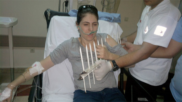 Koluna demir çubuk saplandı - Resim: 4