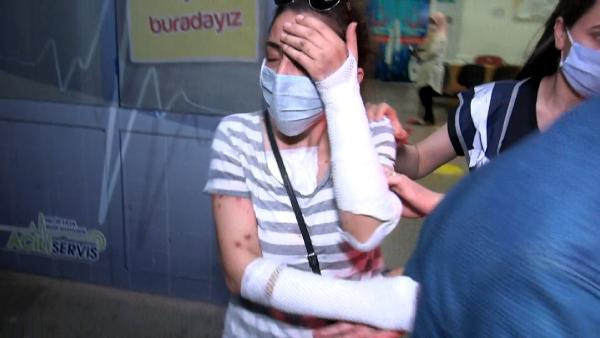 Maraş'ta sevgilisine kezzap atan Fatma Özdaş'tan şok haber virüslü çıktı - Resim: 0