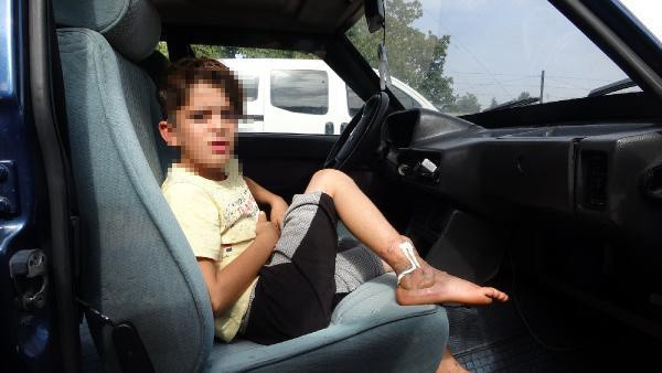 Bursa'da ailesinin zincire vurduğu çocuk yanmaktan son anda kurtuldu! Ailenin savunması şok etti - Resim: 2