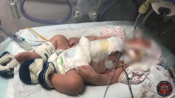 21 yıl aradan sonra ikinci kez yapıldı! Cerrahpaşa'da zorlu operasyon 11 saat sürdü - Resim: 0