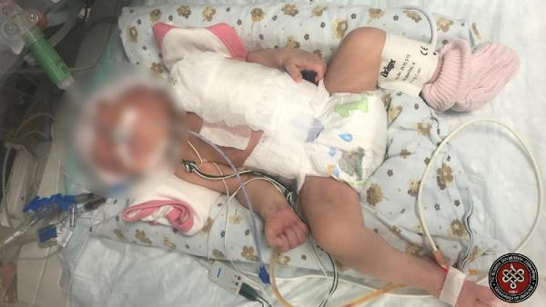 21 yıl aradan sonra ikinci kez yapıldı! Cerrahpaşa'da zorlu operasyon 11 saat sürdü - Resim: 1