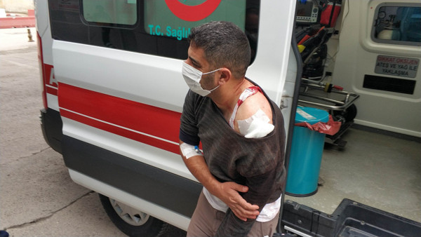 Samsun'da ilginç olay! Babası bıçakladı taburcu olunca kardeşi vurdu! Sebebi bakın ne - Resim: 0