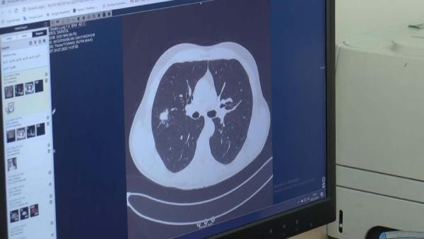 Türkiye'de bir ilki gerçekleştirdiler 11 saat sürdü: Çok büyük sevinç yaşadık - Resim: 4