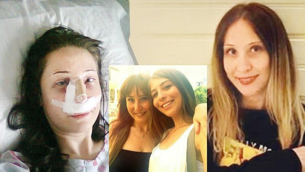 Estetik ameliyat sonrası felaket! Burun ameliyatı oldu bacakları kesildi - Resim: 0