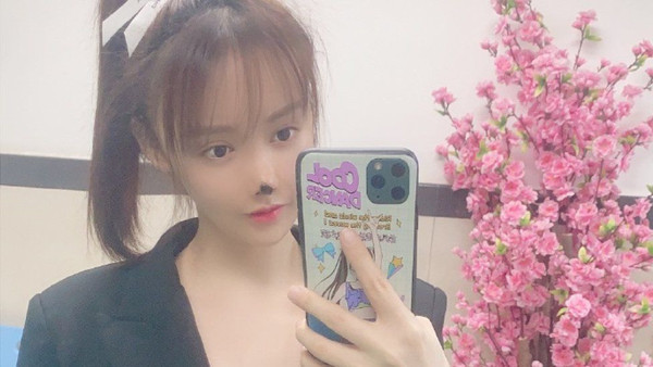 Ünlü oyuncunun feci sonu! Estetik oldu burnu korkunç hale geldi - Resim: 0