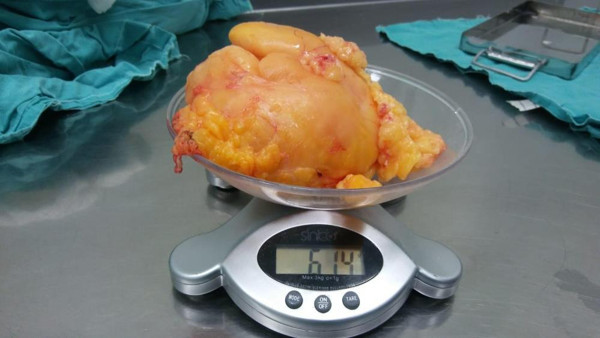 Sakarya'da kitle sebebiyle başvurdu dizinden çıkan doktorları şaşırttı - Resim: 0