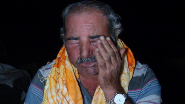 Antalya'da çoban neye uğradığını şaşırdı! Yüzü şişti gözleri kapandı: Saçımdan ayaklarıma kadar... - Resim: 0