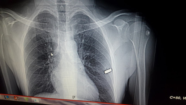 Kaburgasında mermiyle yaşıyordu! Rize'de 15 Temmuz gazisi feci şekilde can verdi - Resim: 1