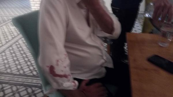 Didim Belediye Başkanı Deniz Atabay'a saldırı sonrası görüntüler ortaya çıktı - Resim: 1