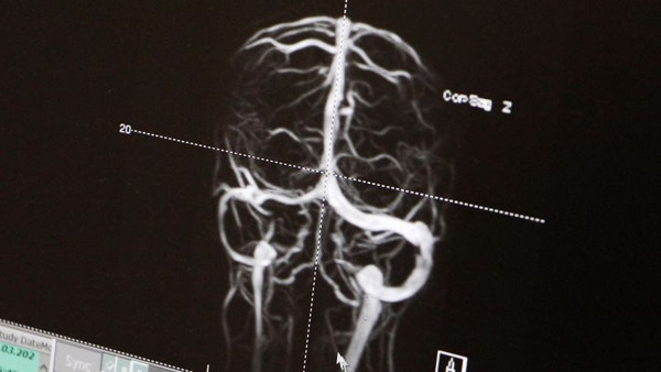 Samsun'da doktor tesadüfen muayene edince ortaya çıktı: Tedavi edilmezse... - Resim: 1