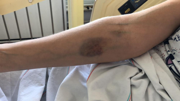 Kocaeli'de kapıyı açınca olanlar oldu! Kabusu yaşadı: 5 saat boyunca... - Resim: 1