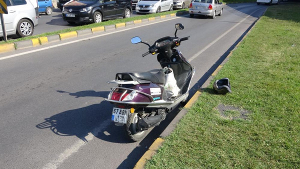 Zonguldak'ta feci kaza! Yüzünde kesikler oldu kanlar içinde kaldı: Meğer... - Resim: 0
