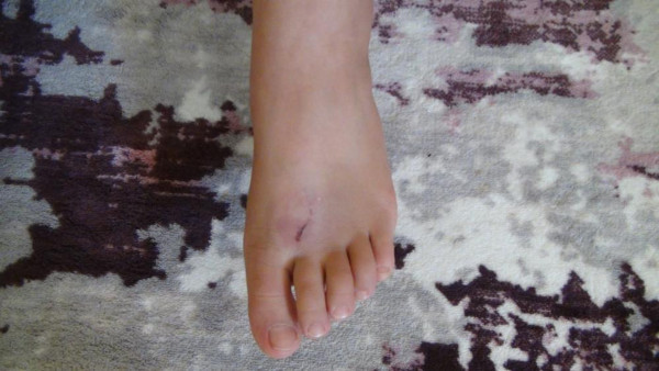 Antalya'da bir anda ayağına deyince kabusu yaşadı: Çok acı çekti - Resim: 0