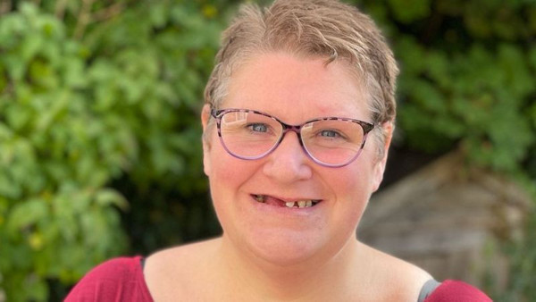 Yeni kriz patlak verdi! Kendi dişlerini çekmeye başladılar: Her gün ağrı kesici almak zorunda kalıyorum - Resim: 0